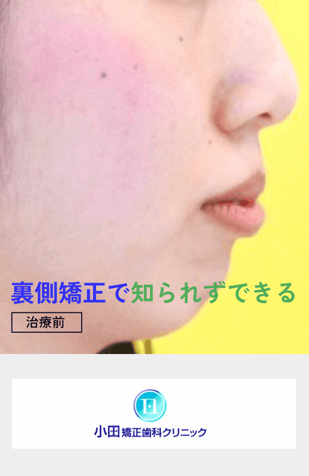 モバイル用gifアニメ画像2